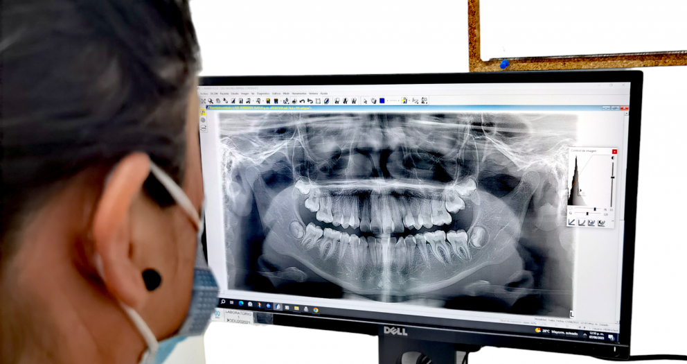 Radiología dental, Tomografía dental, Odontología moderna, Imagenología, Rayos X